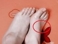 腳上出現青筋是發生什麼事？快檢查一下自己的腳！