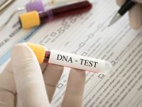 兒子長太帥！爸爸偷驗DNA「發現沒血緣關係」氣到離婚… 媽媽一驗發現「也不是自己生的」 結局傻眼了