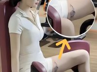 想搭訕健身房美女,卻被腿上「紫斑」嚇到!PO圖求助引網友警告:快跑!會傳染! 想搭訕健身房美女,卻被腿上「紫斑」嚇到!PO圖求助引網友警告:快跑!會傳染!