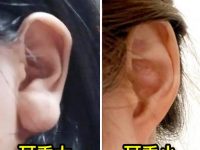 面相揭祕：耳垂大就「大富大貴」耳垂小就「福薄運少」錯了！