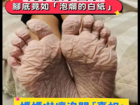 兒子放學回家，腳底竟如「泡爛的白紙」 媽媽嚇壞追問 「真相」卻讓所有人都沉默