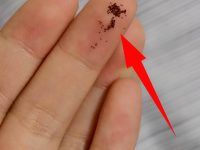 半夜大腿癢「摸到整把黑芝麻」！她開燈秒崩潰...網友1句話「揭真相」直接噁到乾嘔