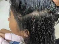 6歲女童「滿頭白髮」嚇壞媽!3歲開始白髮狂冒到現在,全家不知所措 6歲女童「滿頭白髮」嚇壞媽!3歲開始白髮狂冒到現在,全家不知所措