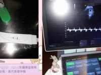 外傭照顧阿公「卻懷孕」 累喊不要再做了！ 家屬痛罵「孩子的爸」 讓網友錯愕：別再折磨人家了