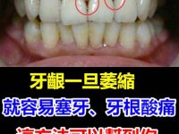 牙齦一旦萎縮，就容易塞牙、牙根酸痛，這方法可以直接幫到你！