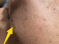 40歲手背驚現棕點！好友一句「老人斑」害他失眠...網友秒回「1句話」秒解心結