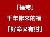 女人身上的5顆「福痣」千年修來的福 「好命又有財」千萬不要點掉